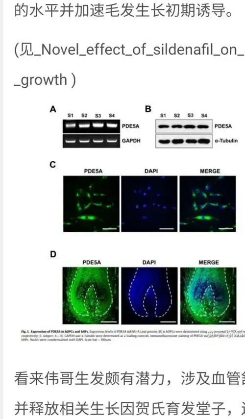 推荐10米诺地尔治疗脱发的人到底是什么成分