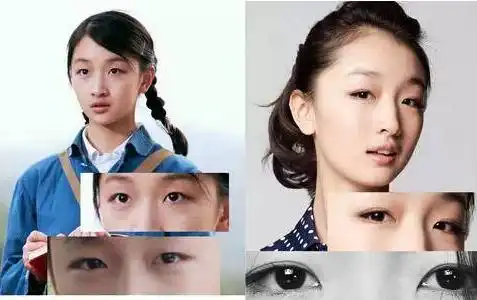 周冬雨割双眼皮网友美呆了