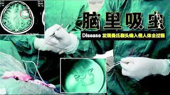 随州小伙疑吃未熟蛙肉脑内现寄生虫致身体萎缩