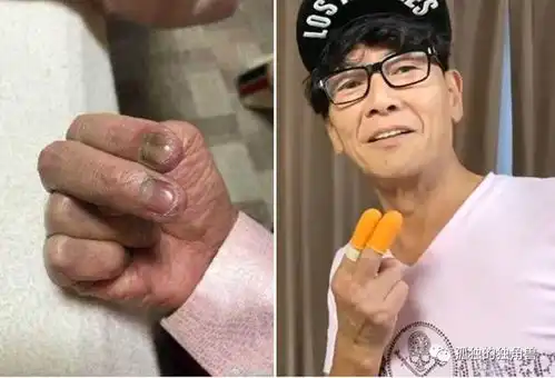 一代金手指,加藤鹰