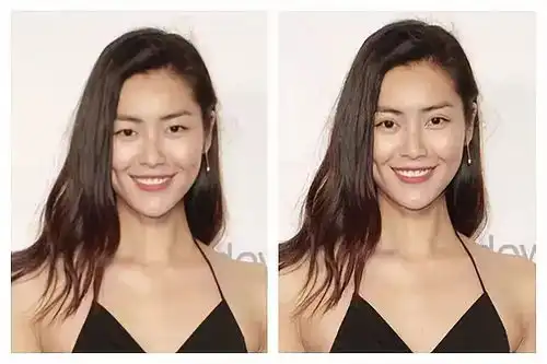 劝你别轻易割双眼皮