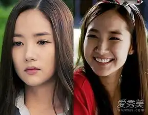 朴敏英9年3次变脸被赞最美整容女星
