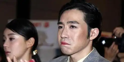 10年前的当红鲜肉,因意外导致毁容,如今甘愿在八佰揭露伤疤
