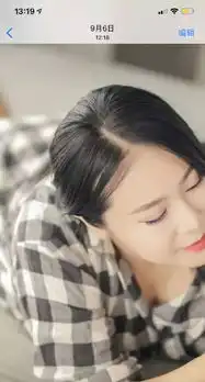 产后脱发秃头,我终于找到办法治你了