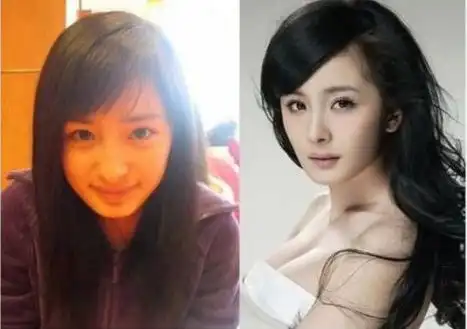 揭娱圈整容变脸女星郑爽变尖下巴张馨予割双眼皮
