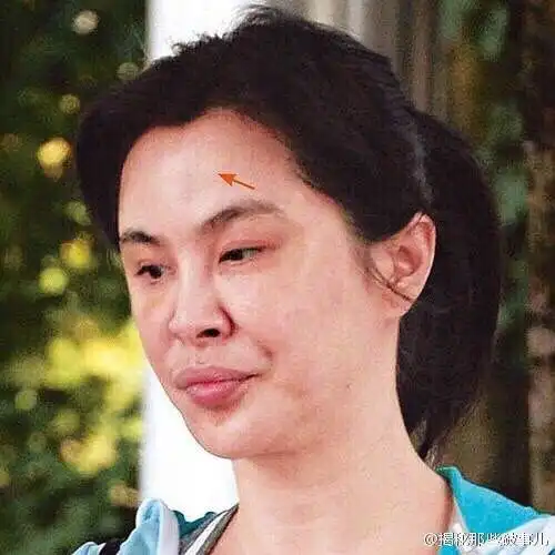 王祖贤变丑是不是因为吸du
