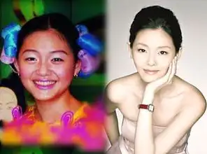 郑爽angelababy沈星40位女星整容前后对比照曝光