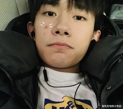 易烊千玺凌晨上线吐槽自己额头长痘烦恼,眼神超a