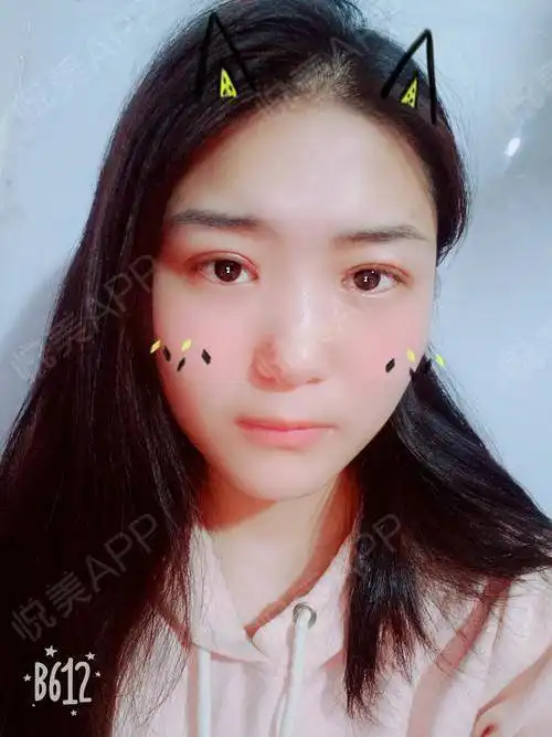 昨天和闺蜜一起去看了找到你,姚晨的台词是这样说...眼综合悦美整形