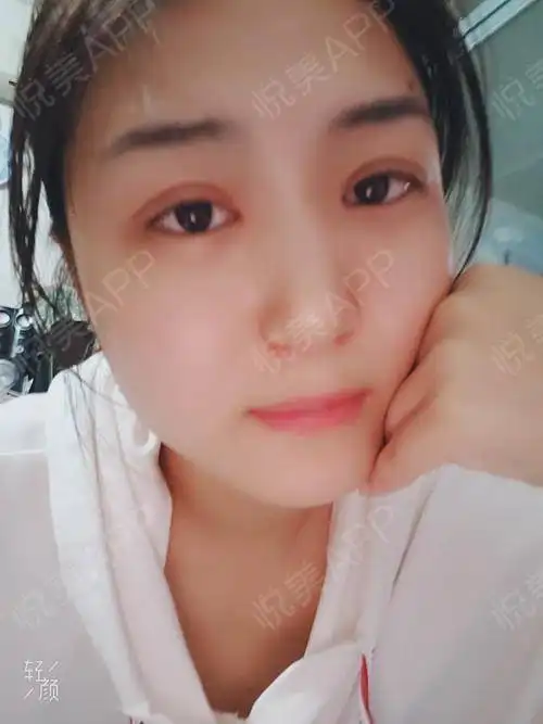 昨天和闺蜜一起去看了找到你,姚晨的台词是这样说...眼综合悦美整形