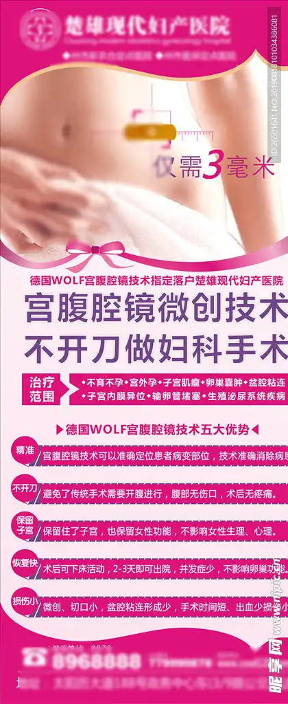 微创妇科宫腹腔镜微创手术设计图
