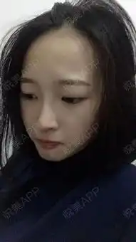 又来更新照片...鼻综合悦美整形
