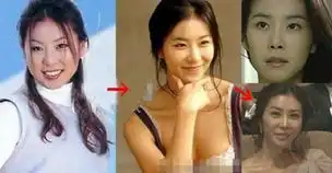 韩一线女星整容对比照郑丽媛李多海尹恩惠蔡琳金素妍变化惊人