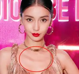 杨颖游玩被路人跟拍,膝盖引起所有人注意,黄晓明也太不贴心了
