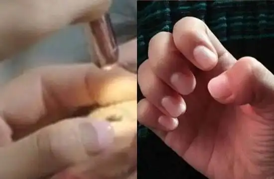 doctors朴信惠涂指甲油动手术挨轰不专业
