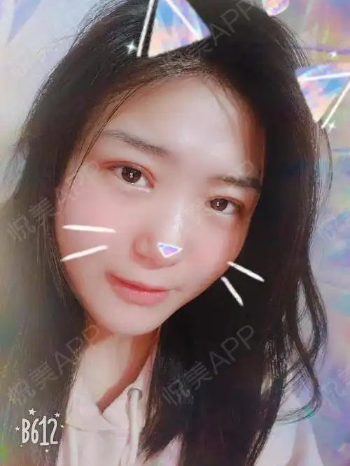 昨天和闺蜜一起去看了找到你,姚晨的台词是这样说...眼综合悦美整形