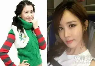 裴涩琪郑爽李多海李颖芝中韩女星整容失败案例
