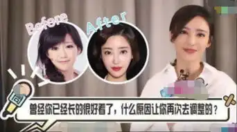 她25岁因病抑郁,不得已跑去整容,倾城时光中人气不输赵丽颖