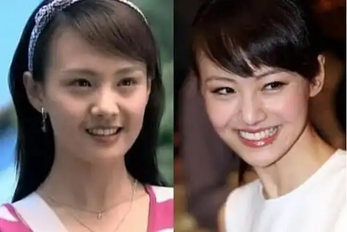 因为整容而走红的5位女星,赵丽颖上榜,柳岩旧照判若两人