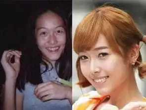 40位女星整容对比照柳岩似大妈周冬雨眼睛肿