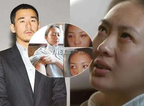 童瑶因戏份少获金鹰视后引质疑,其富豪老公被扒,投资湖南广电
