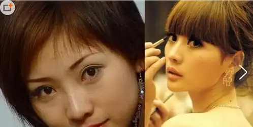 柳岩整容前后照片对比图