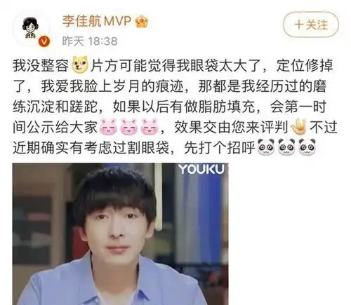 李佳航新剧剧照太违和,被网友质疑整容,本人亲自上线辟谣