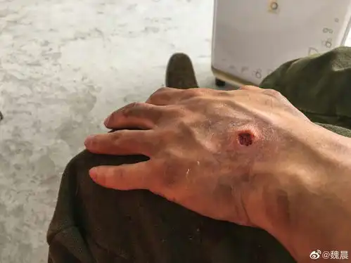 魏晨晒八佰受伤妆剧照赞团队细节至上
