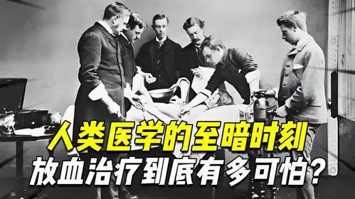 人类医学的至暗时刻中世纪放血治疗到底有多可怕真能治病吗
