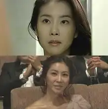 韩国明星遭遇整容副作用整容不美容