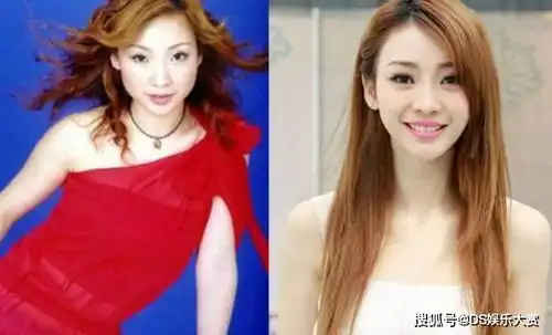 女明星直面整容历史,郑爽自言想改变,周扬青人工美女怎么了
