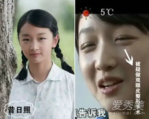 金秀贤李宇春秒变双眼皮图单眼皮化妆师
