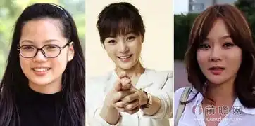 金泰熙崔智友金南珠变老长残整容失败成僵尸脸
