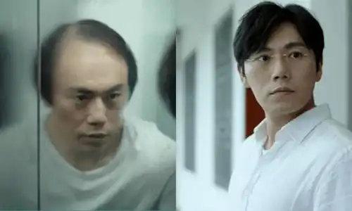 还没来得及变强,头顶已经越来越秃了,怎么办在线等,急头发