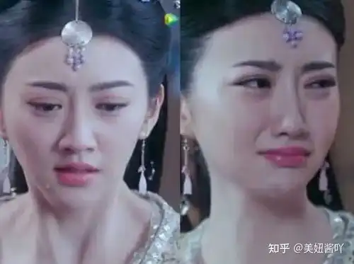 景甜的双眼皮到底是哪个医生修复的