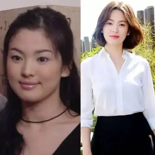 属于易胖体质看完明星瘦身前后你就不会再找理由了