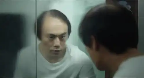 比起减肥,中国大叔越来越爱瘦脸针
