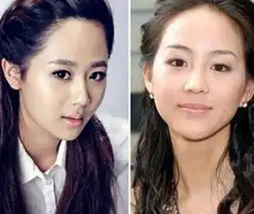 比杨紫频频换脸更可怕的是娄艺潇的脸也成了谜
