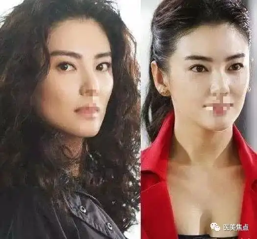 社会绮姐刀砍前夫后又复合看男人的眼光差选医美的眼光怎么样呢