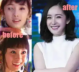 全娱乐圈整过牙的明星来证明牙齿几乎承包了一个人70的颜值,80的气质