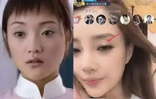 百分之99的明星都割过双眼皮失败的很多,最自然的却是成龙和他
