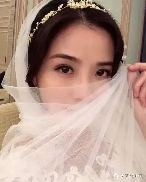 解析脸上8个不同位置的痣代表的含义