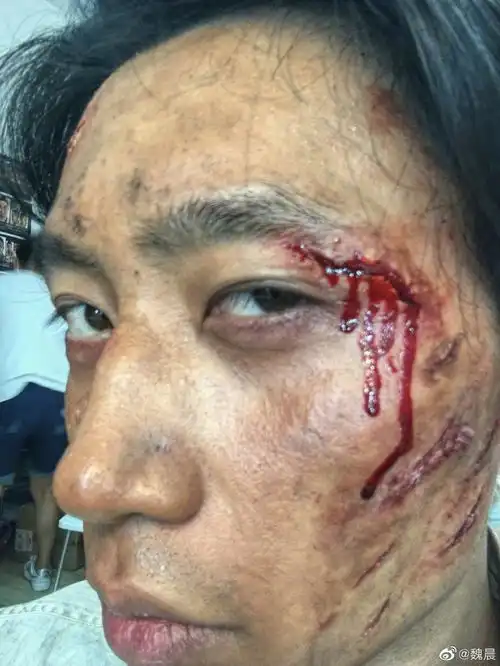 组图魏晨晒16宫格八佰受伤妆剧照赞制作团队细节至上
