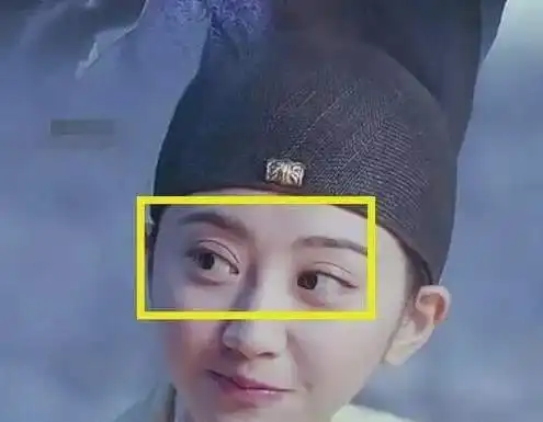 景甜大方说自己do了做埋线双眼皮结果做成悲伤蛙