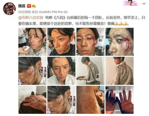 魏晨晒16宫格八佰受伤妆剧照赞制作团队细节至上
